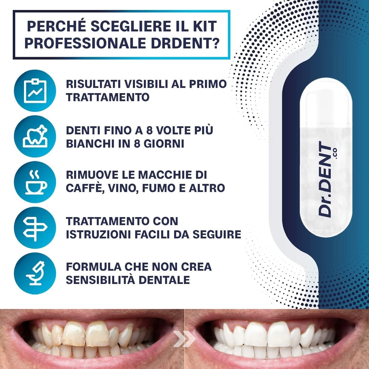 DrDent Kit Sbiancamento Denti Led Professionale - Formula senza sensibilità