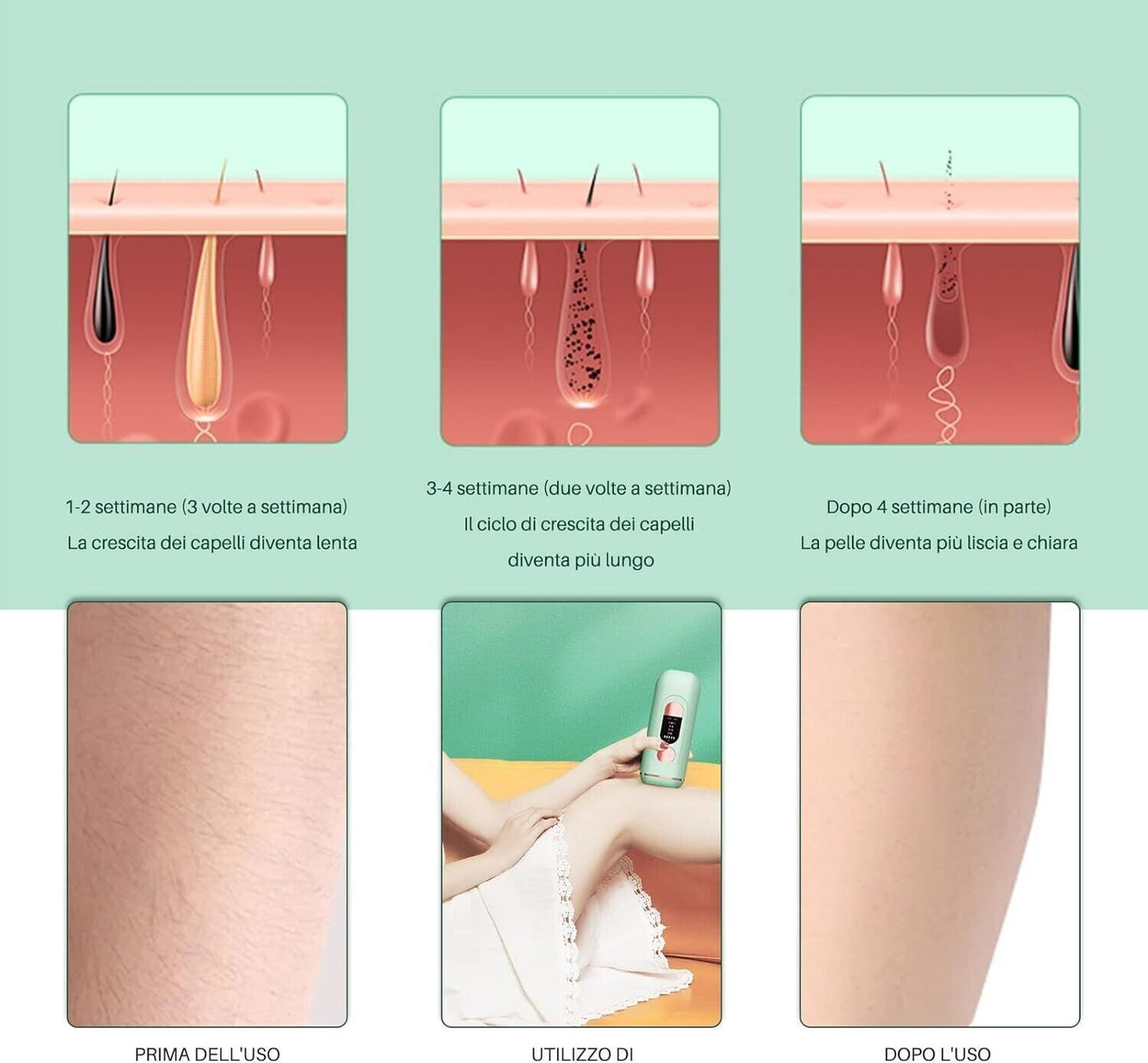 Dispositivo per la depilazione IPL, Depilazione per uomini e donne, Depilazione